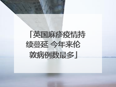 英国麻疹疫情持续蔓延 今年来伦敦病例数最多